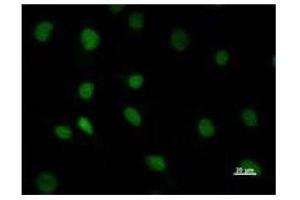 Immunostaining analysis in HeLa cells.