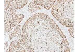 IHC-P Image Immunohistochemical analysis of paraffin-embedded Cal27 xenograft, using VDAC1, antibody at 1:500 dilution.