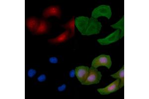 ABIN6256178 and ABIN6267536 staining Hela cells by IF/ICC. (MAP2K3 anticorps  (pSer189))