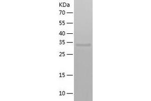 Western Blotting (WB) image for ARP8 Actin-Related Protein 8 Homolog (ACTR8) (AA 1-329) protein (His-IF2DI Tag) (ABIN7121895)