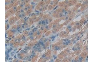 Detection of CTSL in Rat Intestine Tissue using Polyclonal Antibody to Cathepsin L (CTSL) (Cathepsin L anticorps  (AA 114-288))
