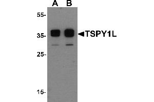 Western Blotting (WB) image for anti-TSPY1L (C-Term) antibody (ABIN1077408) (TSPY1L (C-Term) anticorps)
