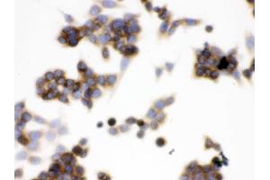 IHC analysis of TCP1 epsilon using anti-TCP1 epsilon antibody .