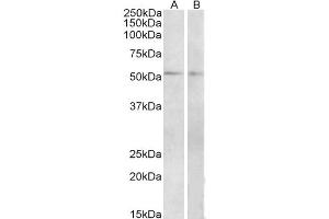 Western Blot (2μg/ml) staining of Mouse (A) and Rat (B) Small Intestine lysate (35μg protein in RIPA buffer). (VIPR1 anticorps  (Internal Region))