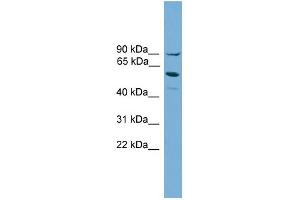 WB Suggested Anti-ALOX15B Antibody Titration:  0. (ALOX15B anticorps  (Middle Region))