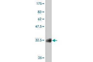 Western Blot detection against Immunogen (36. (CTNNB1 anticorps  (AA 682-781))