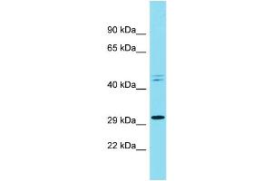 Host: Rabbit Target Name: RND3 Sample Type: NCI-H226 Whole Cell lysates Antibody Dilution: 1.