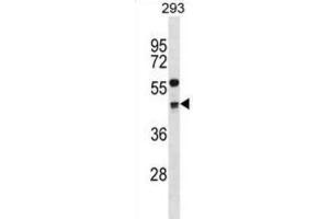 Western Blotting (WB) image for anti-Cyclin G2 (CCNG2) antibody (ABIN2998927) (Cyclin G2 anticorps)