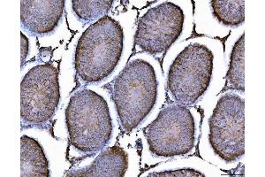 IHC analysis of AHA1/AHSA1 using anti-AHA1/AHSA1 antibody (ABIN7600708). (AHSA1 anticorps  (AA 221-264))