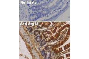 Immunohistochemistry (IHC) image for anti-Autophagy Related 12 (ATG12) (N-Term) antibody (ABIN6254241)