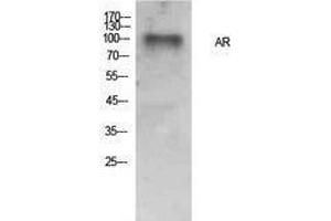 Western Blotting (WB) image for anti-Androgen Receptor (AR) (Internal Region) antibody (ABIN3181394) (Androgen Receptor anticorps  (Internal Region))