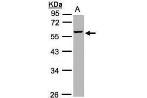 WB Image Sample(30 ug whole cell lysate) A:Hep G2 , 10% SDS PAGE antibody diluted at 1:1000 (MMP3 anticorps)