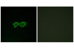Immunofluorescence analysis of LOVO cells, using OR13C4 antibody. (OR13C4 anticorps  (Internal Region))