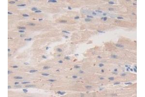 Detection of ErbB3 in Mouse Heart Tissue using Polyclonal Antibody to V-Erb B2 Erythroblastic Leukemia Viral Oncogene Homolog 3 (ErbB3)