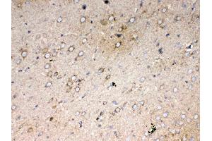 IHC analysis of Cytochrome C using anti-Cytochrome C antibody . (Cytochrome C anticorps  (AA 2-105))