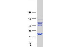 Validation with Western Blot