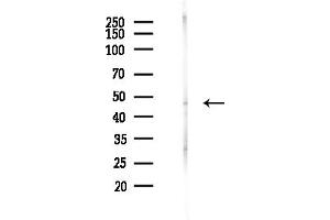 anti-Keratin 32 (KRT32) (Internal Region) antibody
