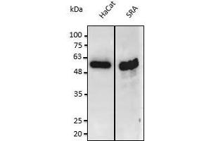 Anti-PS3 Ab at 1/2,500 dilution: lysates at 50 µg of total protein per Iane, rabbit polyclonal to goat lgG (HRP) at 1/10,000 dilution, (p53 anticorps  (C-Term))