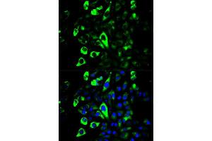 Immunofluorescence (IF) image for anti-Granzyme B (GZMB) antibody (ABIN1875446)