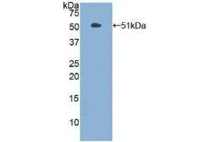 Detection of Recombinant PKM2, Human using Polyclonal Antibody to Pyruvate kinase isozymes M2 (PKM2) (PKM2 anticorps  (AA 294-470))