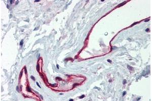 Human Colon, Vessels (formalin-fixed, paraffin-embedded) stained with DARC antibody ABIN337034 at 2. (DARC anticorps  (C-Term))