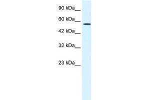 WB Suggested Anti-MEIS2 Antibody Titration:  1. (MEIS2 anticorps  (N-Term))