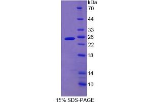 Image no. 1 for Cytoglobin (CYGB) (AA 1-190) protein (His tag) (ABIN4989244) (CYGB Protein (AA 1-190) (His tag))