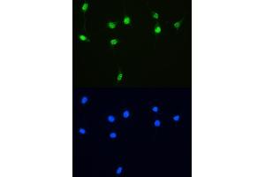 IF analysis of XRCC1 using anti-XRCC1 antibody (ABIN5693138).