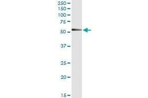 Immunoprecipitation of RNF25 transfected lysate using anti-RNF25 MaxPab rabbit polyclonal antibody and Protein A Magnetic Bead , and immunoblotted with RNF25 MaxPab mouse polyclonal antibody (B01) .