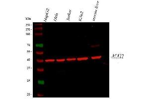 Western blot analysis of ACAT2 using anti-ACAT2 antibody (ABIN7601268).