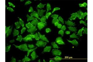 Immunofluorescence of monoclonal antibody to BPNT1 on HeLa cell.