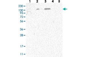 Western blot analysis of Lane 1: RT-4, Lane 2: U-251 MG, Lane 3: Human Plasma, Lane 4: Liver, Lane 5: Tonsil with SPOCD1 polyclonal antibody  at 1:250-1:500 dilution. (SPOCD1 anticorps)