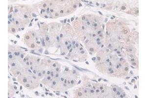 Detection of FKBP4 in Human Stomach Tissue using Polyclonal Antibody to FK506 Binding Protein 4 (FKBP4)