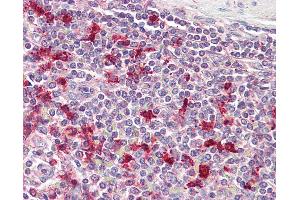 Anti-PTMA antibody IHC of human spleen. (PTMA anticorps  (AA 89-101))