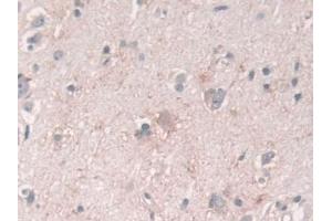 Detection of USP6NL in Human Cerebrum Tissue using Polyclonal Antibody to USP6 N-Terminal Like Protein (USP6NL) (USP6NL anticorps  (AA 1-292))