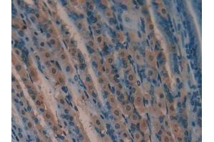 Detection of SOD2 in Mouse Stomach Tissue using Polyclonal Antibody to Superoxide Dismutase 2, Mitochondrial (SOD2)