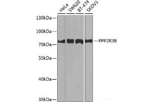 Western blot analysis of extracts of various cell lines using PPP2R3B Polyclonal Antibody at dilution of 1:1000. (PPP2R3B anticorps)