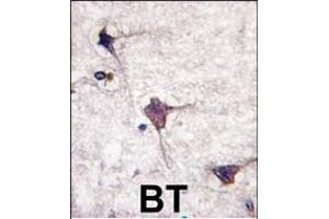 Formalin-fixed and paraffin-embedded human brain tissue reacted with hPCPTP1-, which was peroxidase-conjugated to the secondary antibody, followed by DAB staining. (PTPRR anticorps  (N-Term))
