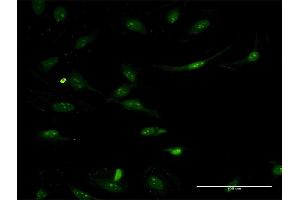 Immunofluorescence of monoclonal antibody to ASS1 on HeLa cell. (ASS1 anticorps  (AA 121-220))