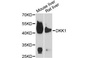 Western blot analysis of extracts of various cell lines, using DKK1 antibody (ABIN5971387) at 1/1000 dilution. (DKK1 anticorps)