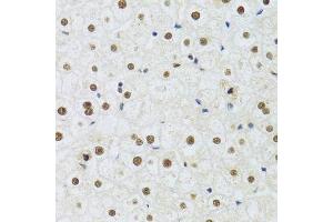 Immunohistochemistry of paraffin-embedded human liver using DDB1 Antibody. (DDB1 anticorps)