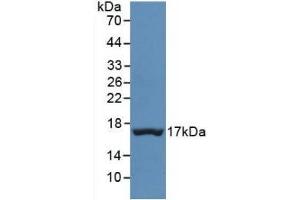 Detection of Recombinant TTR, Human using Monoclonal Antibody to Prealbumin (PALB)
