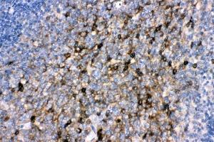 anti-CD82 (CD82) (AA 98-267) antibody