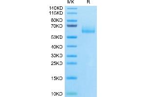 Mucin 1 (MUC1) (AA 24-158) protein (Fc Tag)