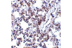 Immunohistochemistry of BAP31 in rat lung tissue with BAP31 antibody at 2 μg/ml.
