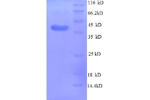 SDS-PAGE (SDS) image for Midkine (Neurite Growth-Promoting Factor 2) (MDK) (AA 21-143) protein (GST tag) (ABIN5712738)