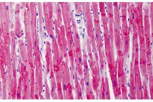 Human Heart: Formalin-Fixed, Paraffin-Embedded (FFPE)