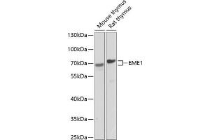 Western blot analysis of extracts of various cell lines, using EME1 antibody (ABIN6127301, ABIN6140155, ABIN6140156 and ABIN6224416) at 1:1000 dilution. (Crossover junction endonuclease EME1 (EME1) (AA 1-320) anticorps)