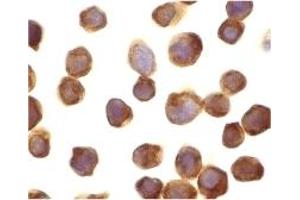 Immunohistochemistry (IHC) image for anti-Death-Associated Protein Kinase 3 (DAPK3) (Middle Region) antibody (ABIN1031183) (DAPK3 anticorps  (Middle Region))