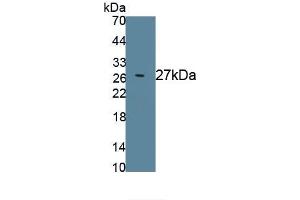 Detection of Recombinant KLK3, Rat using Polyclonal Antibody to Prostate Specific Antigen (PSA) (Prostate Specific Antigen anticorps  (AA 68-255))